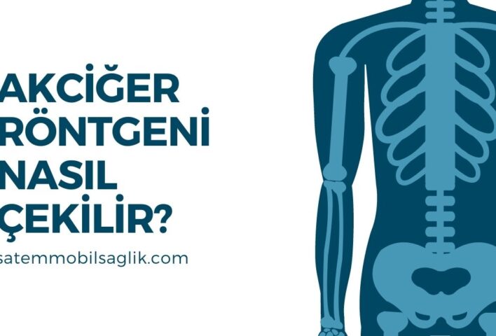 Akciğer Röntgeni Nasıl Çekilir?
