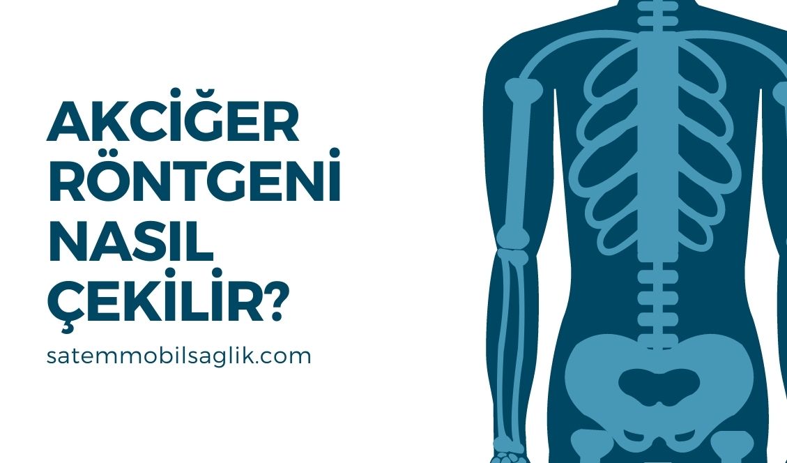 Akciğer Röntgeni Nasıl Çekilir?