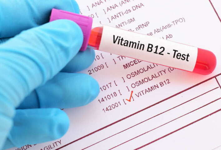B12 Testi