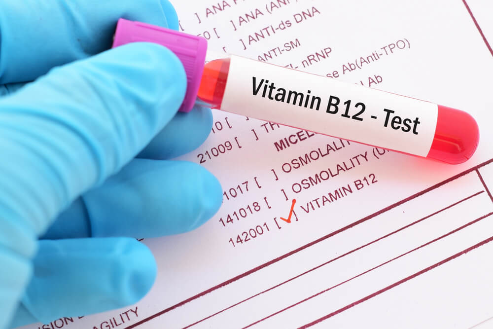 B12 Testi