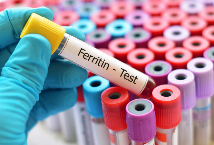 Ferritin Testi