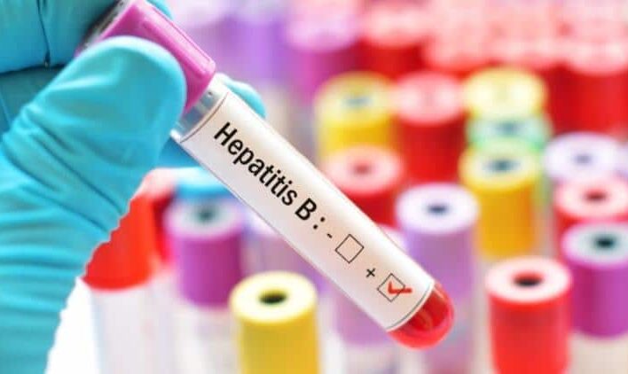 Hepatit B Testi