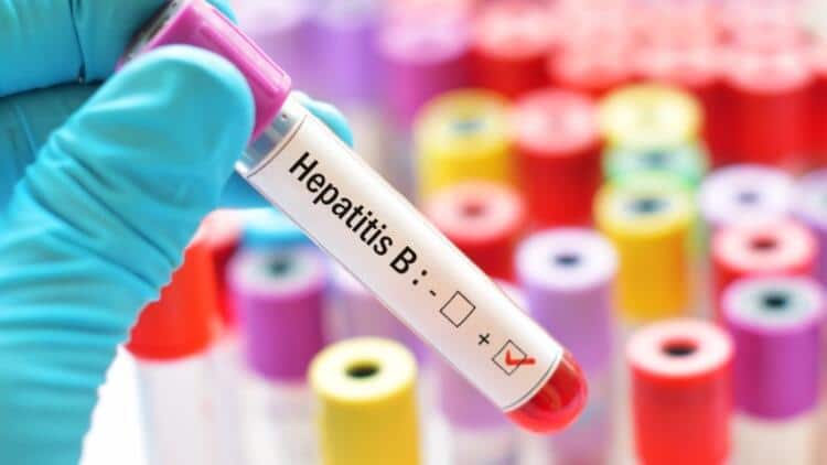 Hepatit B Testi