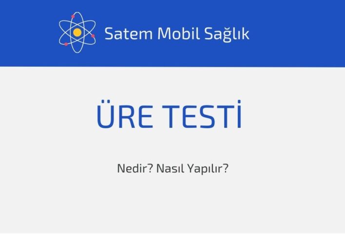 Üre Testi