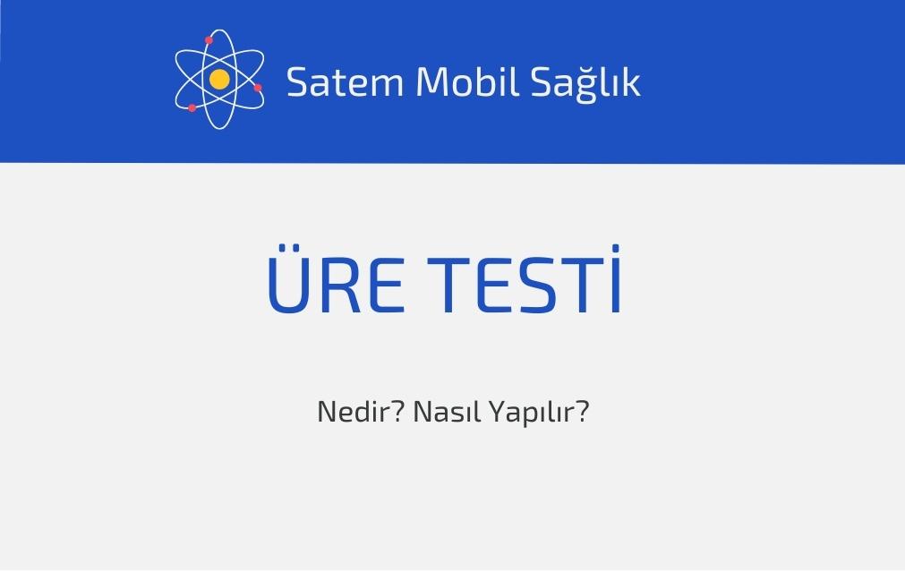 Üre Testi
